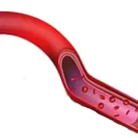 circulatory health