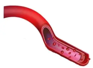 circulatory health